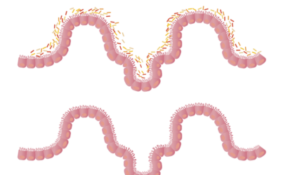 Hyperperméabilité : comment rendre l’intestin moins poreux et retrouver un meilleur confort digestif.
